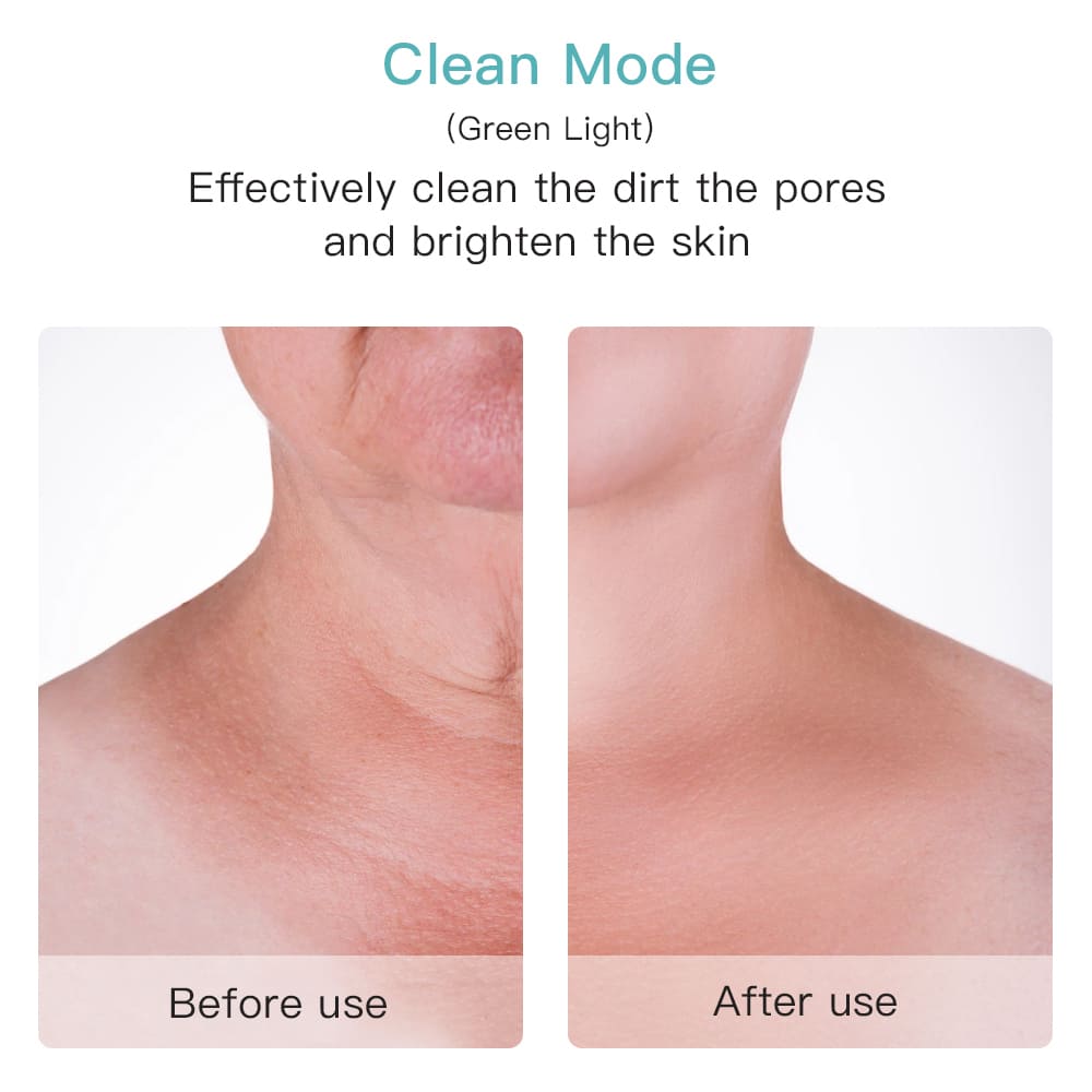 Limpiador de poros eficaz en la cara o el cuello antes después